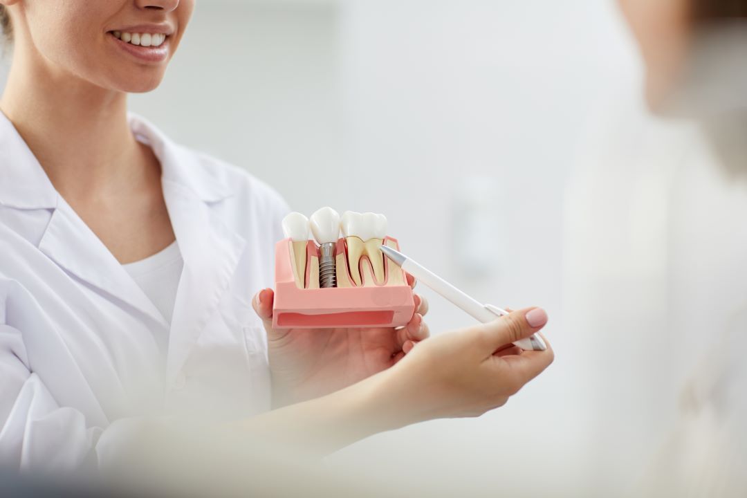 Dental Implants in Saint Cloud, FL