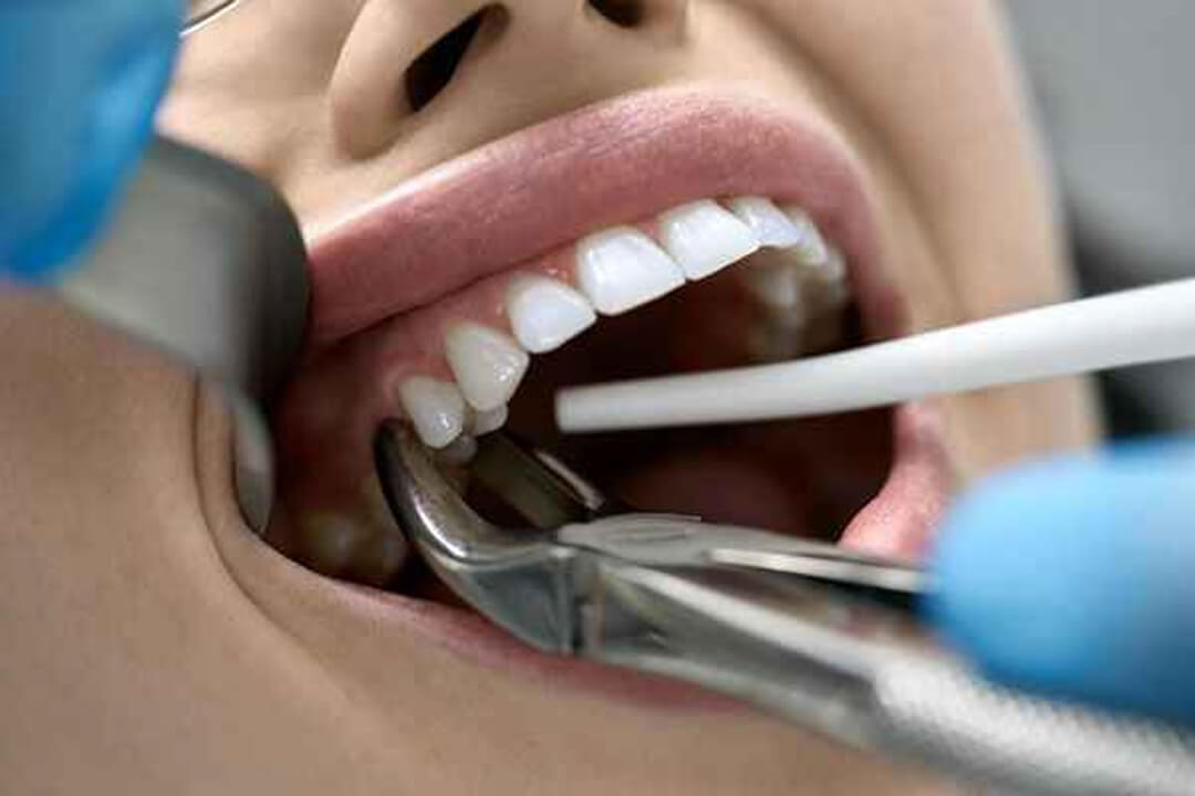 dental care near twin lakes